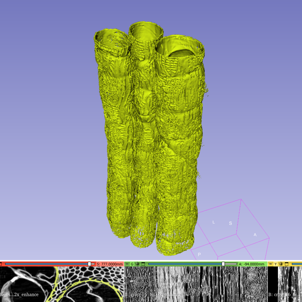 3D segmentation of the oak vessels